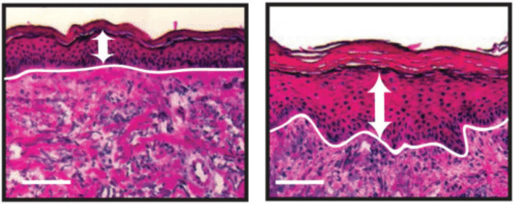 Retinoids Revealed: Understanding the Cellular and Molecular Changes in Your Skin