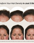 Full Follicle Advanced Scalp Serum