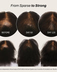 Full Follicle Advanced Scalp Serum