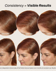 Full Follicle Advanced Scalp Serum