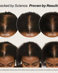 Full Follicle Advanced Scalp Serum