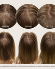 Full Follicle Advanced Scalp Serum