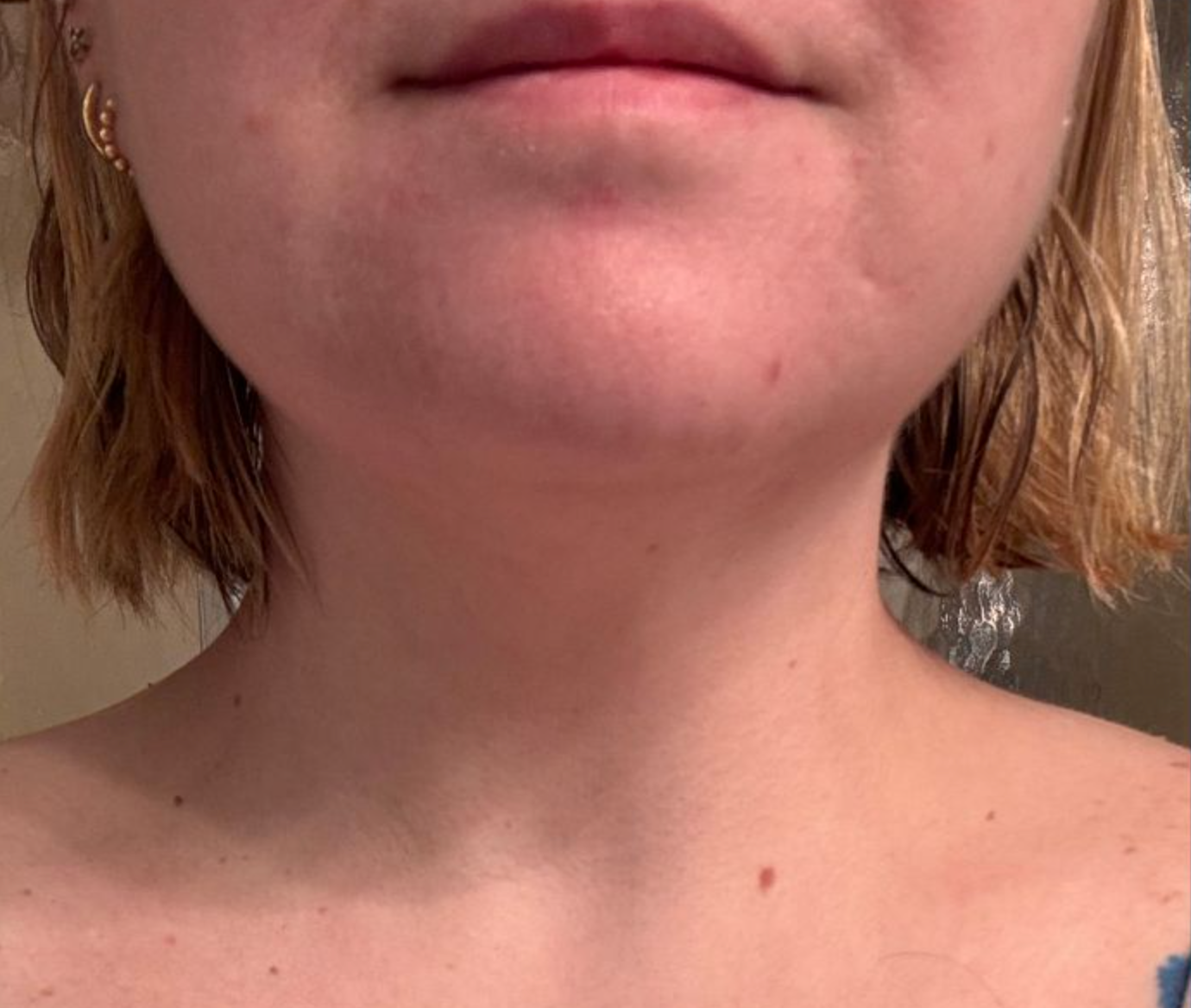 Your neck is aging faster than your face. Here's why.