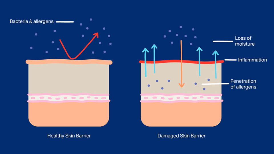 Skin Barrier 101