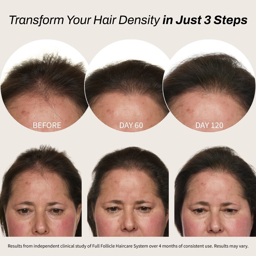 Full Follicle Advanced Scalp Serum