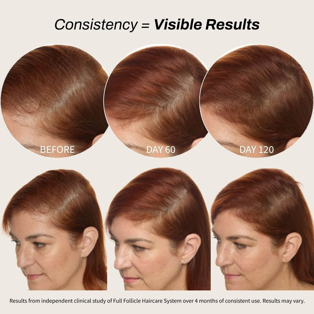 Full Follicle System for Thicker Hair