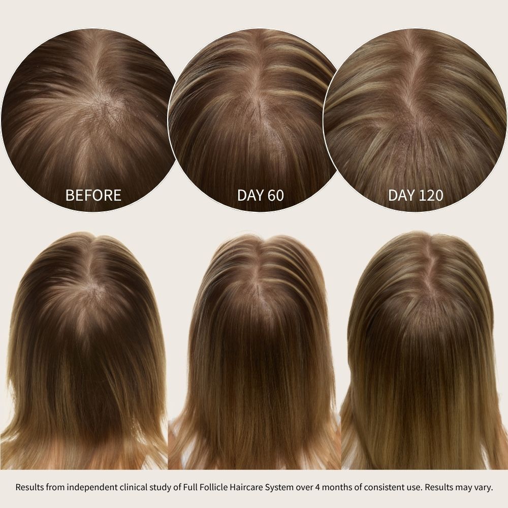Full Follicle System for Thicker Hair