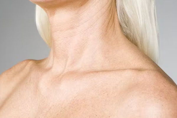 Aging neck
